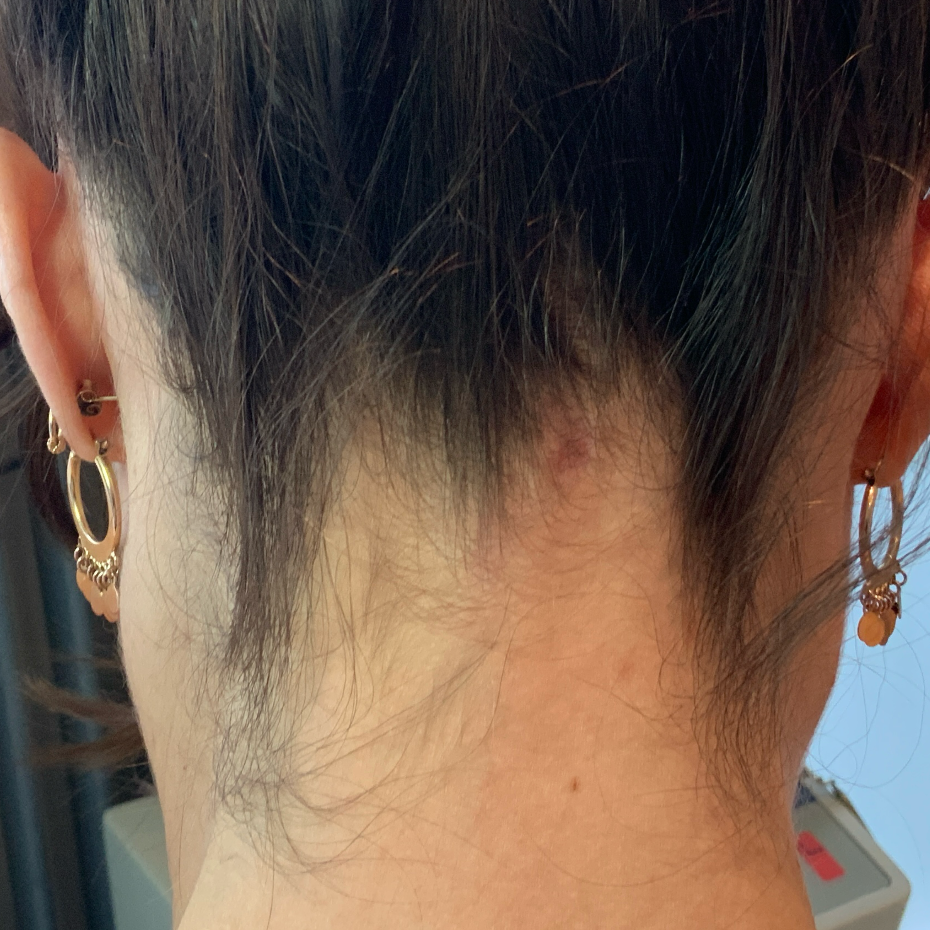 Result after healing - After