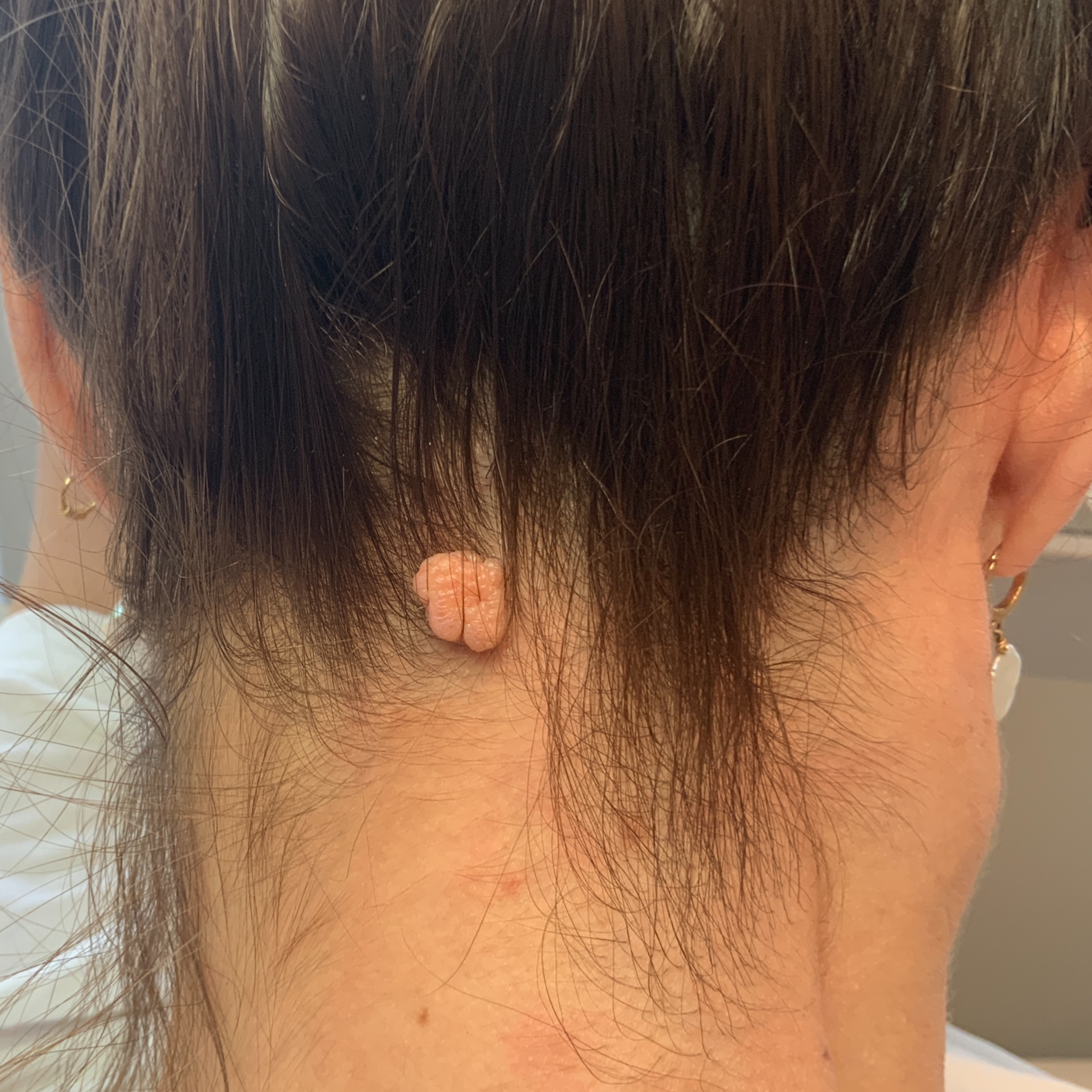 Result after healing - Before